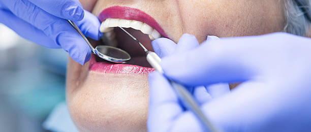 Best Emergency Dental Care for Sports Injuries in Kent, WA